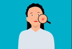 Complexion Struggles and Solutions